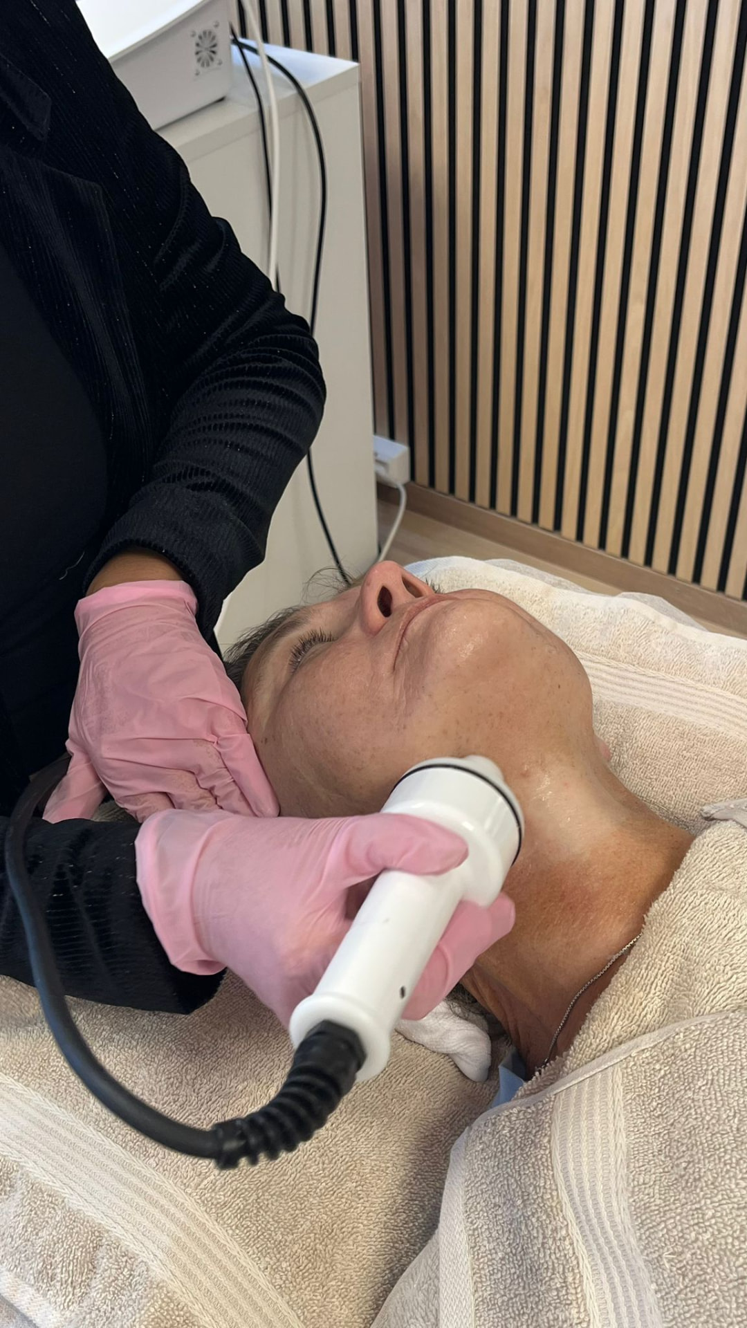 Nærbilde av RF dobbelthake-behandling i klinikk