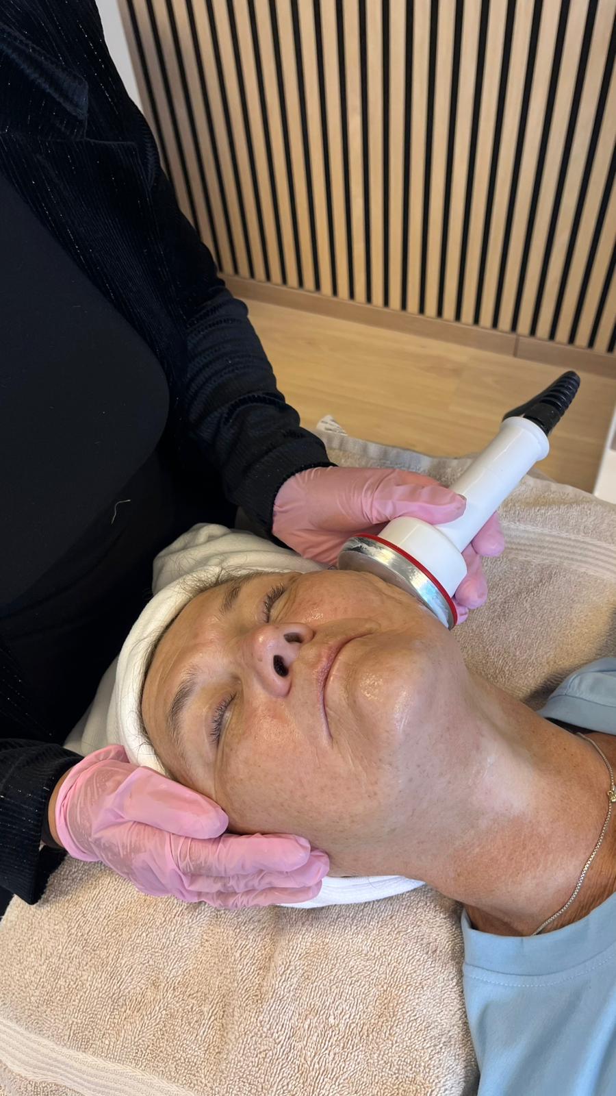 RF-behandling med dyprens hos Velora Sculpt